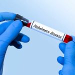 Alzheimer's Blood Test Could 'Revolutionize' Diagnosis And Other Info alzheimers-blood-test