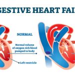habits-that-lead-to-stroke
